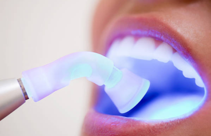 Tooth with light flashing through it, demonstrating gum disease, cavities, and general oral hygiene.