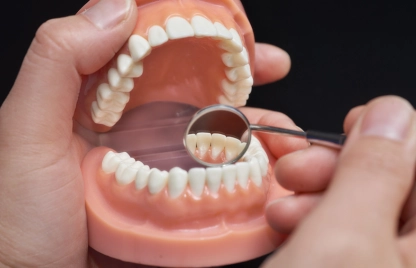  A Dentist examining a tooth with a magnifying glass, focusing on Dental Crown And Bridge Treatment.