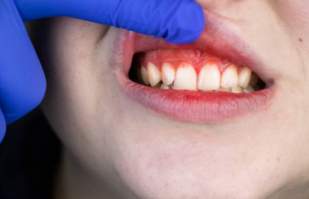 The dentist is checking the patient's teeth and gums using dental tools to treat gum disease.