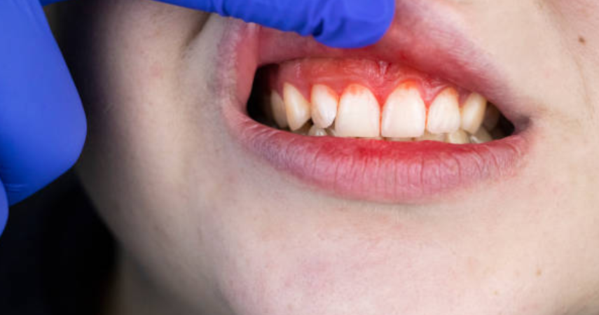 The dentist is checking the patient's teeth and gums using dental tools to treat gum disease.