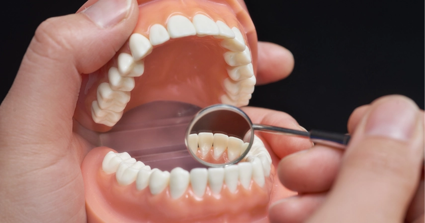  A Dentist examining a tooth with a magnifying glass, focusing on Dental crown and bridge treatment